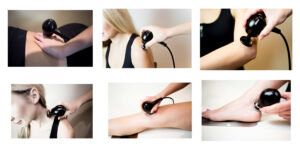 Tecar Therapy