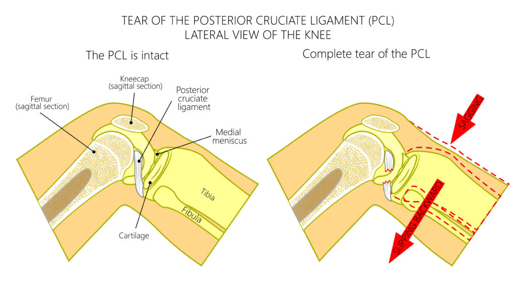 Physiotherapy For Knee Injuries In Scarborough