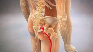 physiotherapy-treatment-for-sciatica-in-toronto
