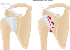 shoulder capsule