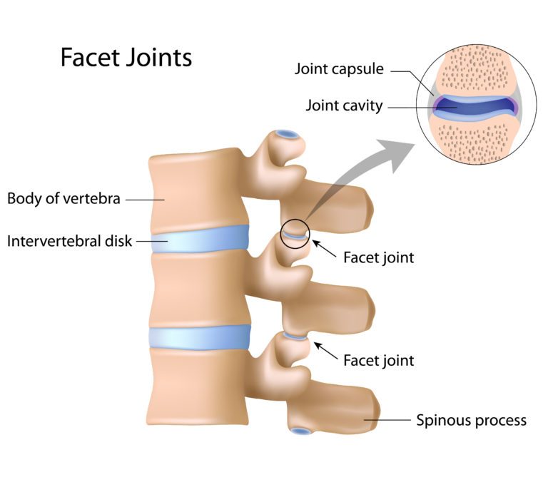 Visit Our Physiotherapist For Spinal Osteoarthritis Simply Align Rehab 0451